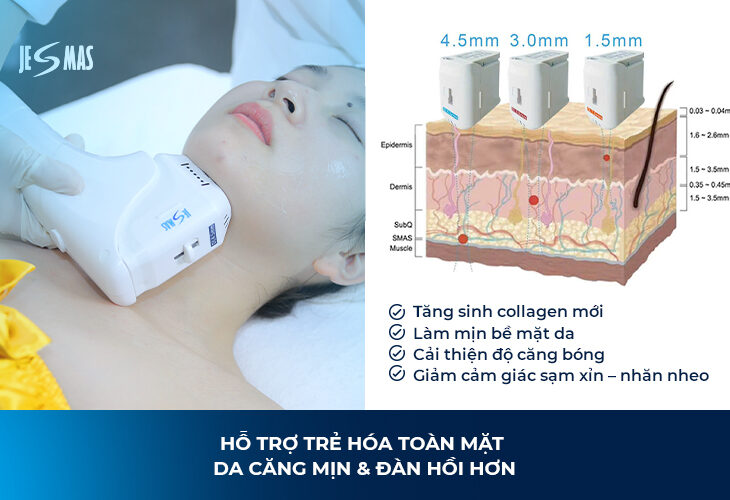 HIFU Làm Tăng Sinh Collagen Như Thế Nào?