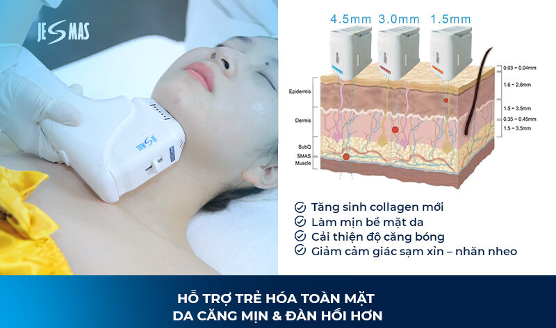 HIFU Làm Tăng Sinh Collagen Như Thế Nào?