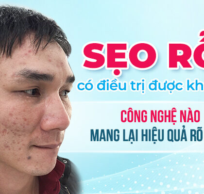 Trị Sẹo Rỗ Hiệu Quả #1 – Phác Đồ Chuẩn Da Liễu Từ A–Z