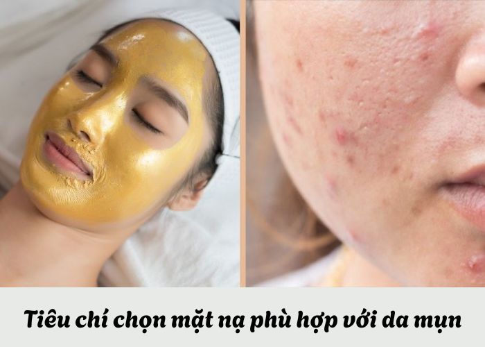 tiêu chí chọn mặt nạ da mụn